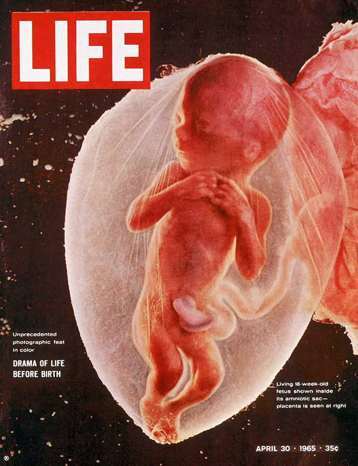 La célèbre photo d'un foetus humain Photo : Lennart Nilsson/Life Magazine